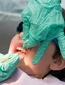 Understanding Pediatric Fluoride Treatment