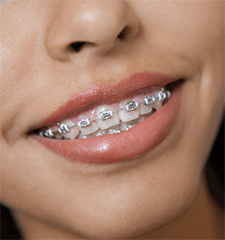 Teeth Trauma: It's a Sensitive Issue