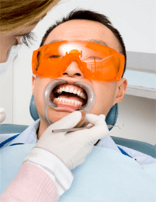 Choosing the Right Professional Teeth Whitening Treatment
