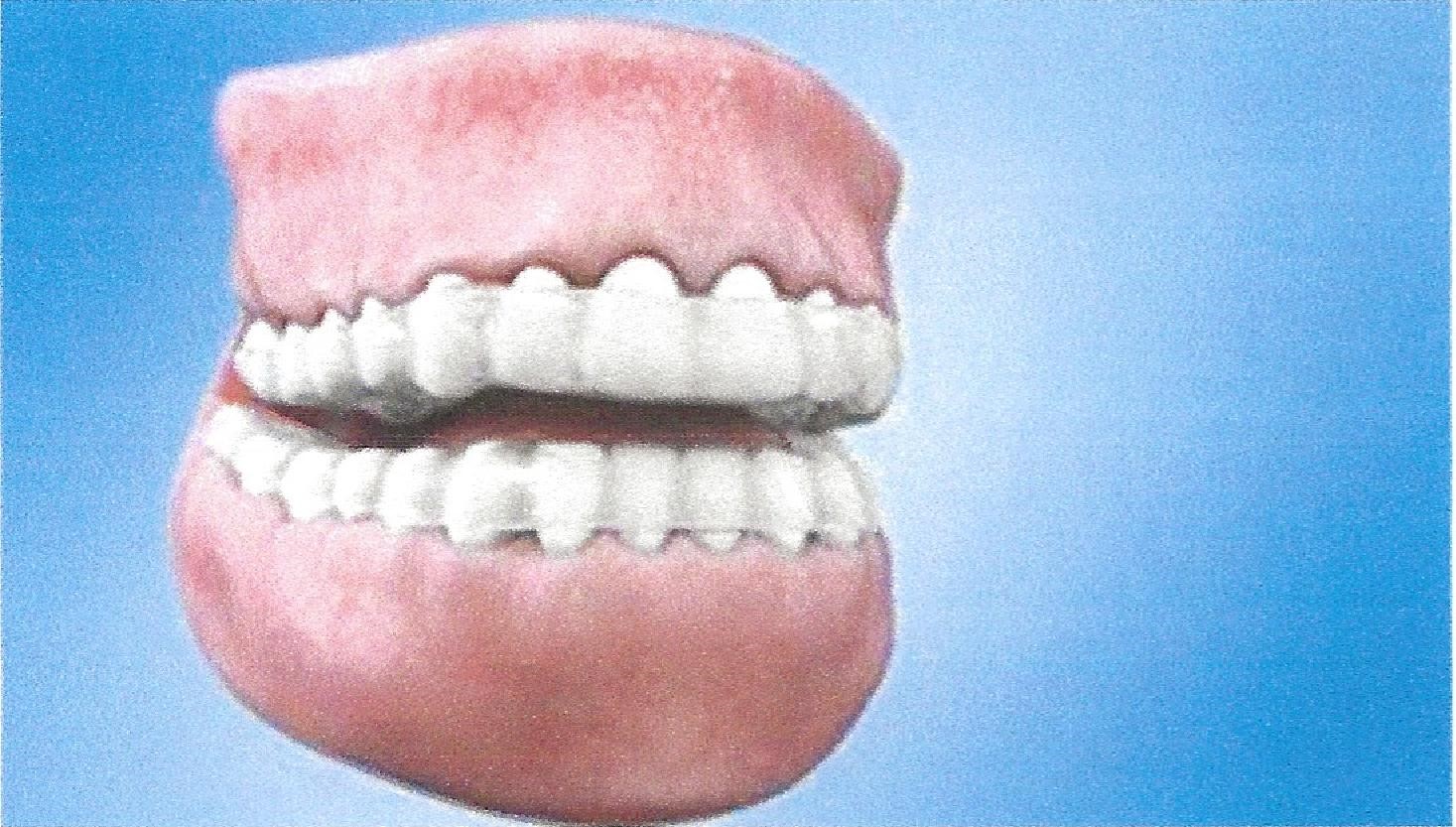 Teeth Trauma: It's a Sensitive Issue