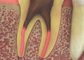 Teeth Trauma: It's a Sensitive Issue