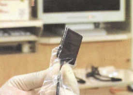 Teeth Trauma: It's a Sensitive Issue