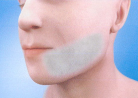 Teeth Trauma: It's a Sensitive Issue