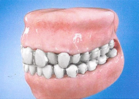 Teeth Trauma: It's a Sensitive Issue