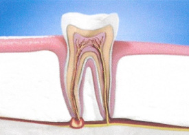 Teeth Trauma: It's a Sensitive Issue