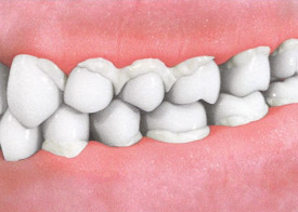 Teeth Trauma: It's a Sensitive Issue