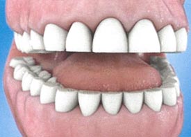 Teeth Trauma: It's a Sensitive Issue