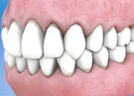 Teeth Trauma: It's a Sensitive Issue