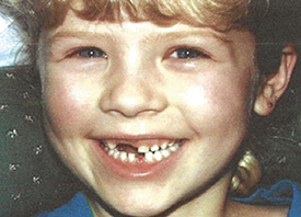 Teeth Trauma: It's a Sensitive Issue