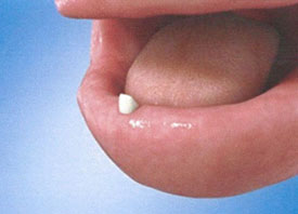 Teeth Trauma: It's a Sensitive Issue