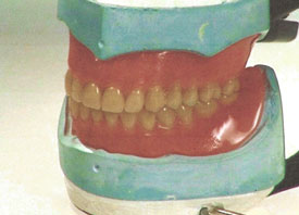 Teeth Trauma: It's a Sensitive Issue