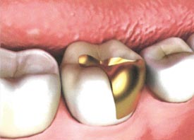 Teeth Trauma: It's a Sensitive Issue