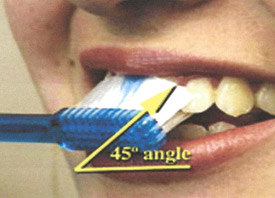 Teeth Trauma: It's a Sensitive Issue